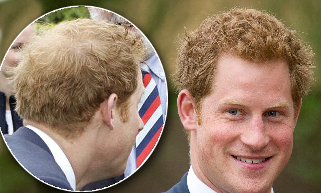 Prince Harry’s hair loss likely to have made him ‘paranoid’ – Trafalgar